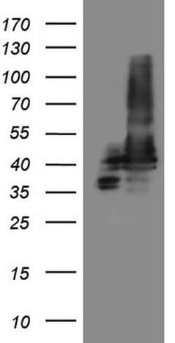 STOML2 Monoclonal Antibody (OTI1F5), TrueMAB , OriGene 30 &mu;L | Buy Online | Origene Technologies | Fisher Scientific