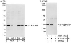 STUB1/CHIP Rabbit anti-Human, Mouse, Polyclonal, Bethyl Laboratories 100
