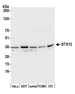 STX12 Polyclonal Antibody, Bethyl Laboratories:Antibodies:Primary Antibodies