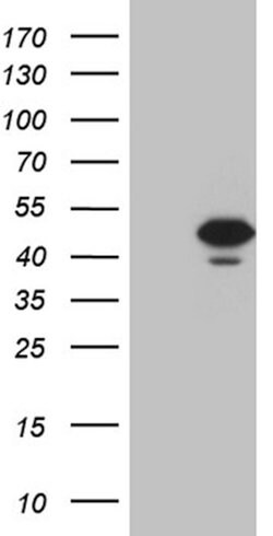 STX18 Mouse anti-Human, Clone: OTI2B5, lyophilized, TrueMAB 100 &mu;g;