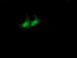 SULT1A1 Monoclonal Antibody (OTI1G10), TrueMAB , OriGene 100 &mu;L; Unconjugated:Antibodies,