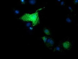 SULT1A1 Mouse anti-Human, Clone: OTI9D10, lyophilized, TrueMAB 100 &mu;g;