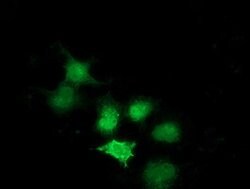 SULT1A1 Mouse anti-Human, Clone: OTI2C5, lyophilized, TrueMAB 100 &mu;g;