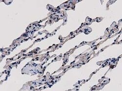 SULT1A1 Mouse anti-Human, Clone: OTI2C5, lyophilized, TrueMAB 100 &mu;g;