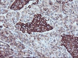 SULT1A1 Monoclonal Antibody (OTI5A1), TrueMAB , OriGene 100 &mu;L; Unconjugated:Antibodies,