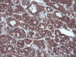 SULT1A1 Monoclonal Antibody (OTI5A1), TrueMAB , OriGene 100 &mu;L; Unconjugated:Antibodies,