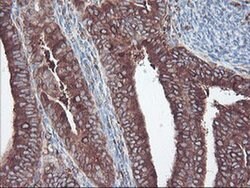 SULT1A1 Monoclonal Antibody (OTI5A1), TrueMAB , OriGene 100 &mu;L; Unconjugated:Antibodies,