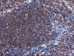 SULT1A1 Monoclonal Antibody (OTI5A1), TrueMAB , OriGene:Antibodies:Primary