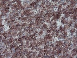 SULT1A1 Monoclonal Antibody (OTI5A1), TrueMAB , OriGene 100 &mu;L; Unconjugated:Antibodies,
