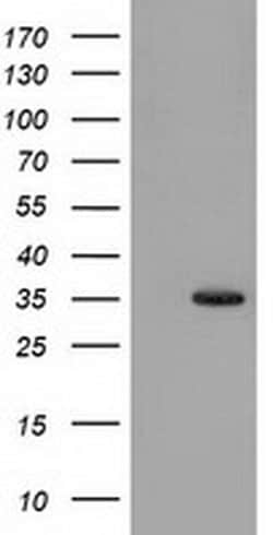 SULT1A1 Monoclonal Antibody (OTI8B8), TrueMAB , OriGene 100 &mu;L; Unconjugated:Antibodies,
