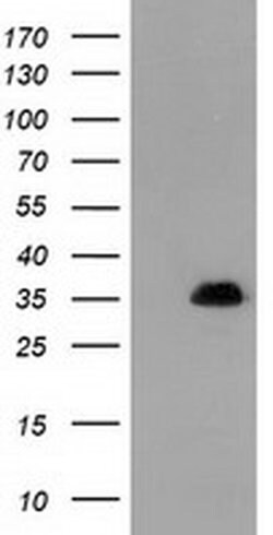 SULT1A1 Monoclonal Antibody (OTI1G10), TrueMAB , OriGene 100 &mu;L; Unconjugated:Antibodies,