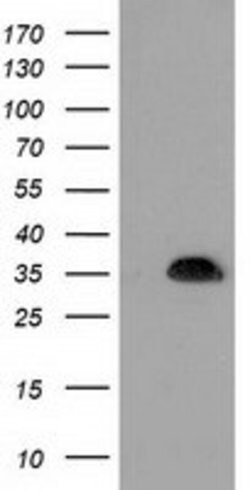 SULT1A1 Mouse anti-Human, Clone: OTI2C5, lyophilized, TrueMAB 100 &mu;g;