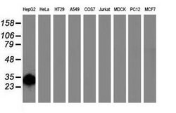 SULT1A1 Mouse anti-Human, Clone: OTI2C5, lyophilized, TrueMAB 100 &mu;g;
