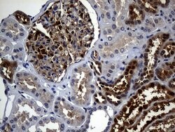 SULT1A3 Mouse anti-Human, Clone: OTI3G5, lyophilized, TrueMAB 100 &mu;g;