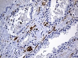 SULT1A3 Monoclonal Antibody (OTI6A8), TrueMAB , OriGene 100 &mu;L; Unconjugated:Antibodies,