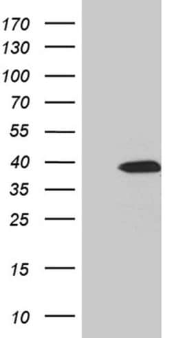 SULT1A3 Monoclonal Antibody (OTI2A9), TrueMAB , OriGene 100 &mu;L; Unconjugated:Antibodies,