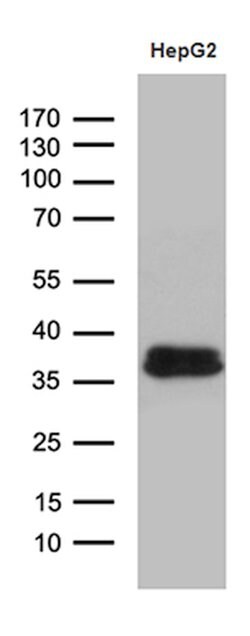 SULT1A3 Mouse anti-Human, Clone: OTI3G5, lyophilized, TrueMAB 100 &mu;g;