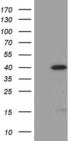 SULT1A3 Mouse anti-Human, Clone: OTI1B6, lyophilized, TrueMAB 100 &mu;g | Buy Online | Origene Technologies | Fisher Scientific