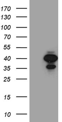 SULT1A3 Monoclonal Antibody (OTI1C6), TrueMAB , OriGene 30 &mu;L; Unconjugated:Antibodies,