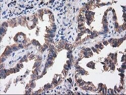 SULT1C2 Mouse anti-Human, Clone: OTI4G1, lyophilized, TrueMAB 100 &mu;g;