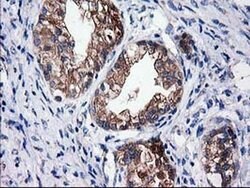 SULT1C2 Monoclonal Antibody (OTI4G1), TrueMAB , OriGene 30 &mu;L; Unconjugated:Antibodies,