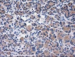 SULT1C2 Mouse anti-Human, Clone: OTI4G1, lyophilized, TrueMAB 100 &mu;g;