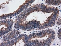 SULT1C2 Mouse anti-Human, Clone: OTI4G1, lyophilized, TrueMAB 100 &mu;g;