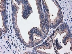 SULT1C2 Mouse anti-Human, Clone: OTI4G1, lyophilized, TrueMAB 100 &mu;g;