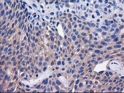 SULT1C2 Mouse anti-Human, Clone: OTI4G1, lyophilized, TrueMAB 100 &mu;g;