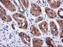 SULT1C2 Mouse anti-Human, Clone: OTI4G1, lyophilized, TrueMAB 100 &mu;g;