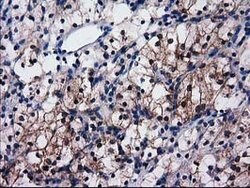 SULT1C2 Mouse anti-Human, Clone: OTI4G1, lyophilized, TrueMAB 100 &mu;g;