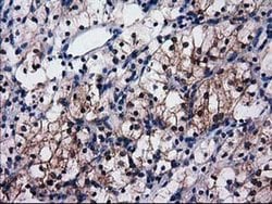 SULT1C2 Monoclonal Antibody (OTI4G1), TrueMAB , OriGene 30 &mu;L; Unconjugated:Antibodies,