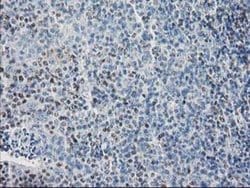 SULT1C2 Monoclonal Antibody (OTI5A11), TrueMAB , OriGene 30 &mu;L; Unconjugated:Antibodies,