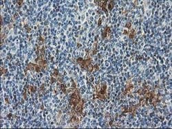SULT1C2 Monoclonal Antibody (OTI5A11), TrueMAB , OriGene 30 &mu;L; Unconjugated:Antibodies,