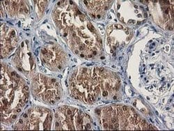 SULT1C2 Monoclonal Antibody (OTI5A11), TrueMAB , OriGene 30 &mu;L; Unconjugated:Antibodies,