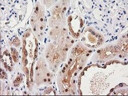 SULT1C2 Mouse anti-Human, Clone: OTI8A1, lyophilized, TrueMAB 100 &mu;g;
