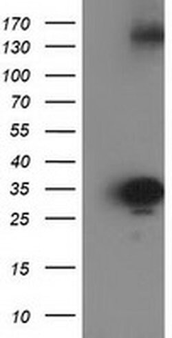 SULT1C2 Monoclonal Antibody (OTI4G1), TrueMAB , OriGene 30 &mu;L; Unconjugated:Antibodies,