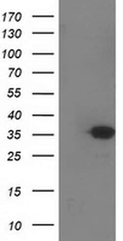 SULT1C2 Monoclonal Antibody (OTI6F2), TrueMAB , OriGene 100 &mu;L; Unconjugated:Antibodies,