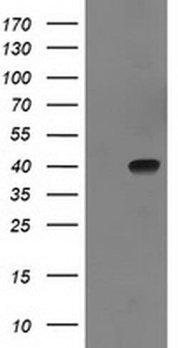 SULT1C2 Monoclonal Antibody (OTI5A4), TrueMAB , OriGene 100 &mu;L | Buy Online | OriGene | Fisher Scientific