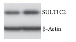 SULT1C2 Monoclonal Antibody (OTI5A4), TrueMAB , OriGene 100 &mu;L | Buy Online | OriGene | Fisher Scientific