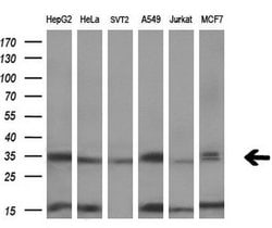 SULT1C2 Monoclonal Antibody (OTI5A4), TrueMAB , OriGene 100 &mu;L | Buy Online | OriGene | Fisher Scientific