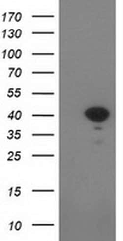 SULT1C2 Monoclonal Antibody (OTI5A11), TrueMAB , OriGene 30 &mu;L; Unconjugated:Antibodies,