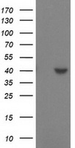 SULT1C2 Monoclonal Antibody (OTI2F5), TrueMAB , OriGene 100 &mu;L; Unconjugated:Antibodies,