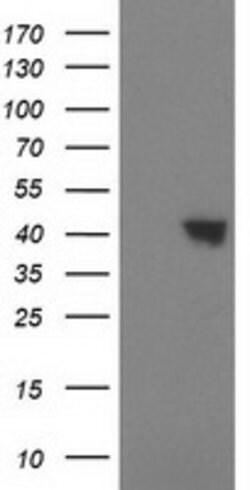 SULT1C2 Mouse anti-Human, Clone: OTI8A1, lyophilized, TrueMAB 100 &mu;g;