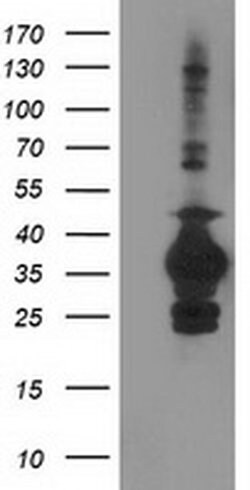 SULT1C2 Monoclonal Antibody (OTI4H4), TrueMAB , OriGene 100 &mu;L; Unconjugated:Antibodies,