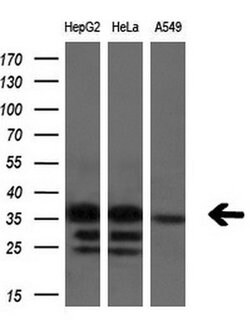 SULT1C2 Monoclonal Antibody (OTI4H4), TrueMAB , OriGene:Antibodies:Primary