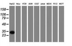 SULT2A1 Monoclonal Antibody (OTI3E8), TrueMAB , OriGene:Antibodies:Primary