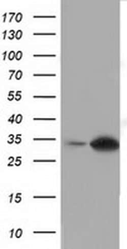 SULT2A1 Monoclonal Antibody (OTI2A6), TrueMAB , OriGene 100 &mu;L; Unconjugated:Antibodies,
