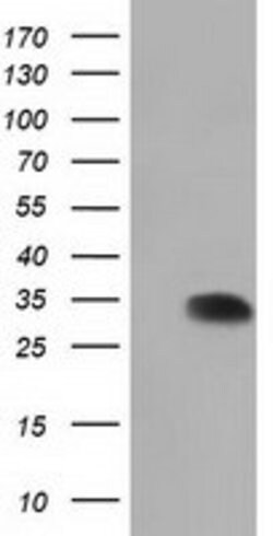 SULT2A1 Mouse anti-Human, Clone: OTI7G10, lyophilized, TrueMAB 100 &mu;g;