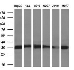 SULT2A1 Mouse anti-Human, Clone: OTI7G10, lyophilized, TrueMAB 100 &mu;g;